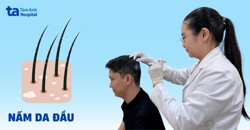 Hình ảnh bác sĩ thú y đang khám da và lấy mẫu cạo da cho chó để chẩn đoán bệnh xà mâu